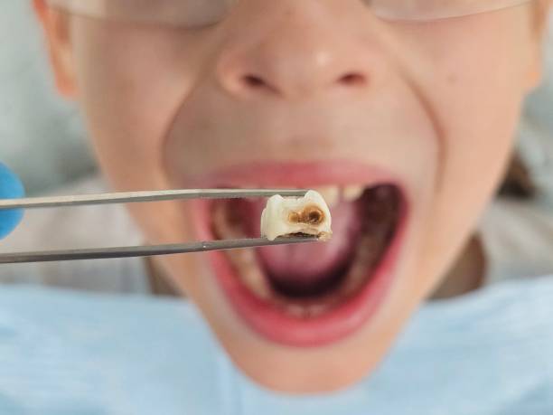 Best Emergency Gum Treatment in Tyler Run, PA